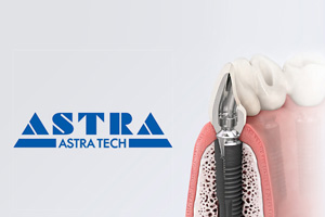 ASTRA ASTRA