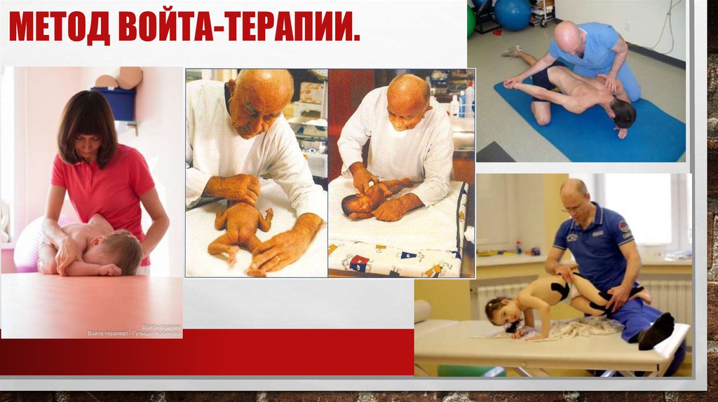 Метод Войта терапии Войта терапия